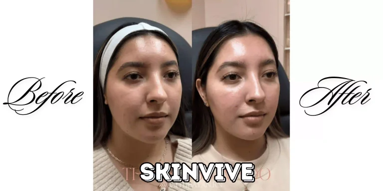 Skinvive Before and After: Real Patient Results and Benefits 3 Skinvive Before and after feature image