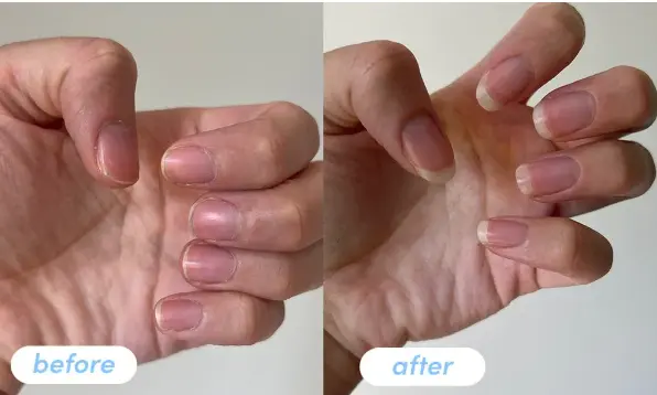 Collagen Supplement Before and After: Real Results You Can See 5 Collagen Supplement Before and After