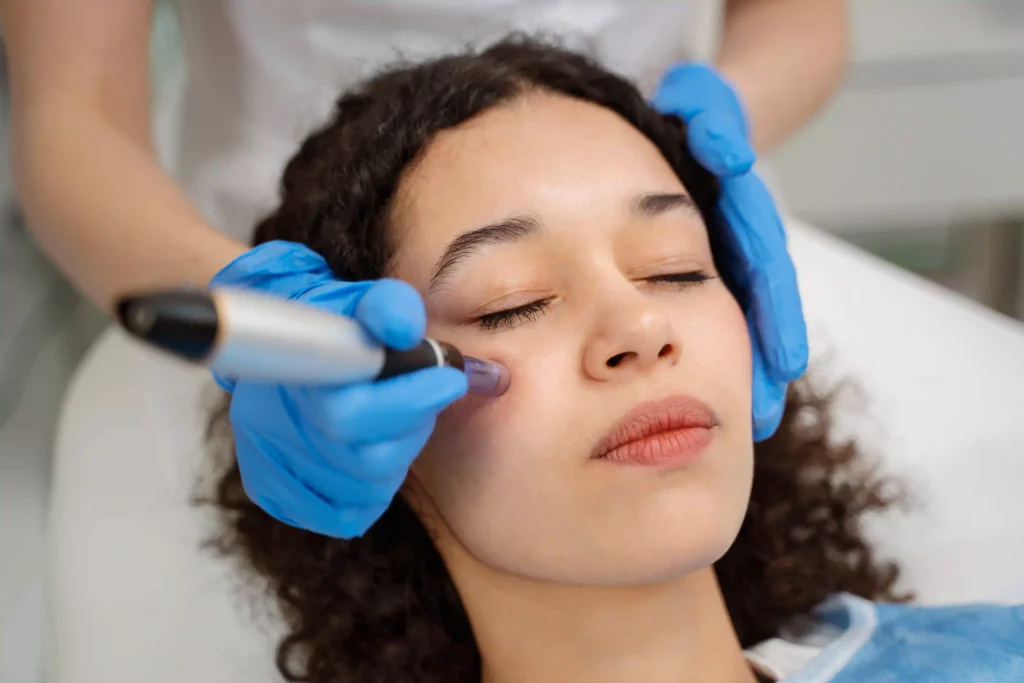 How Much Does Microneedling Cost? A Complete Guide to Pricing and Is It Worth It? 4 how much is microneedling image 3