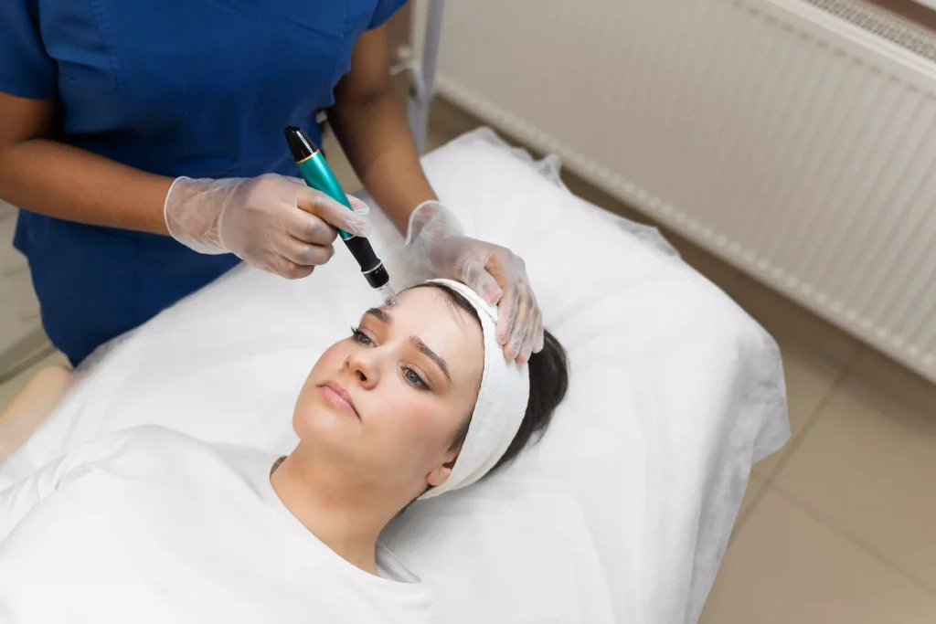 How Much Does Microneedling Cost? A Complete Guide to Pricing and Is It Worth It? 3 how much is microneedling image 2