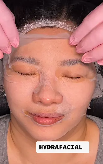 Are Hydrafacials Worth It: Uncover the Real Benefits for Your Skin 3 Are Hydrafacials Worth It